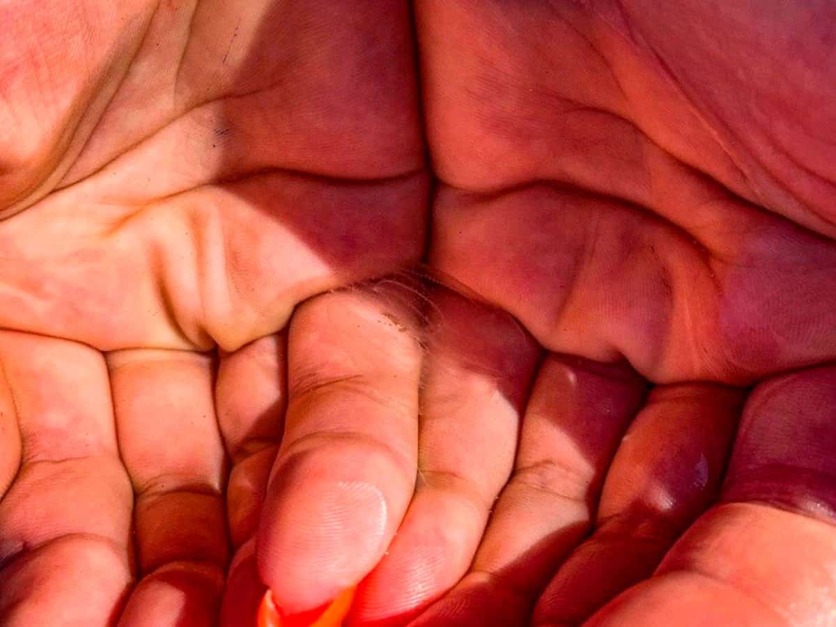 медузы в Коблево